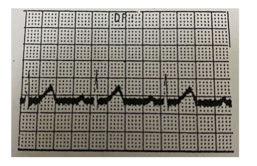 <p>What does this mean?</p>