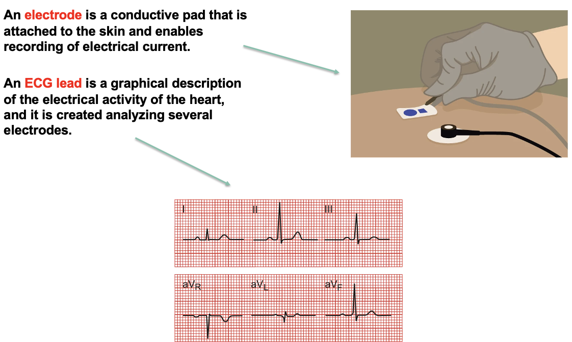 <ul><li><p>an <strong>electrode:</strong> is a <strong><mark data-color="yellow" style="background-color: yellow; color: inherit;">conductive pad </mark></strong>that is attached to the skin and enables <u>recording of the electrical current</u></p></li><li><p>an <strong>ECG lead </strong>is a <strong><mark data-color="yellow" style="background-color: yellow; color: inherit;">graphical description of the electrical activity of the heart,</mark></strong> and it is created analyzing several electrodes</p></li></ul><p></p>