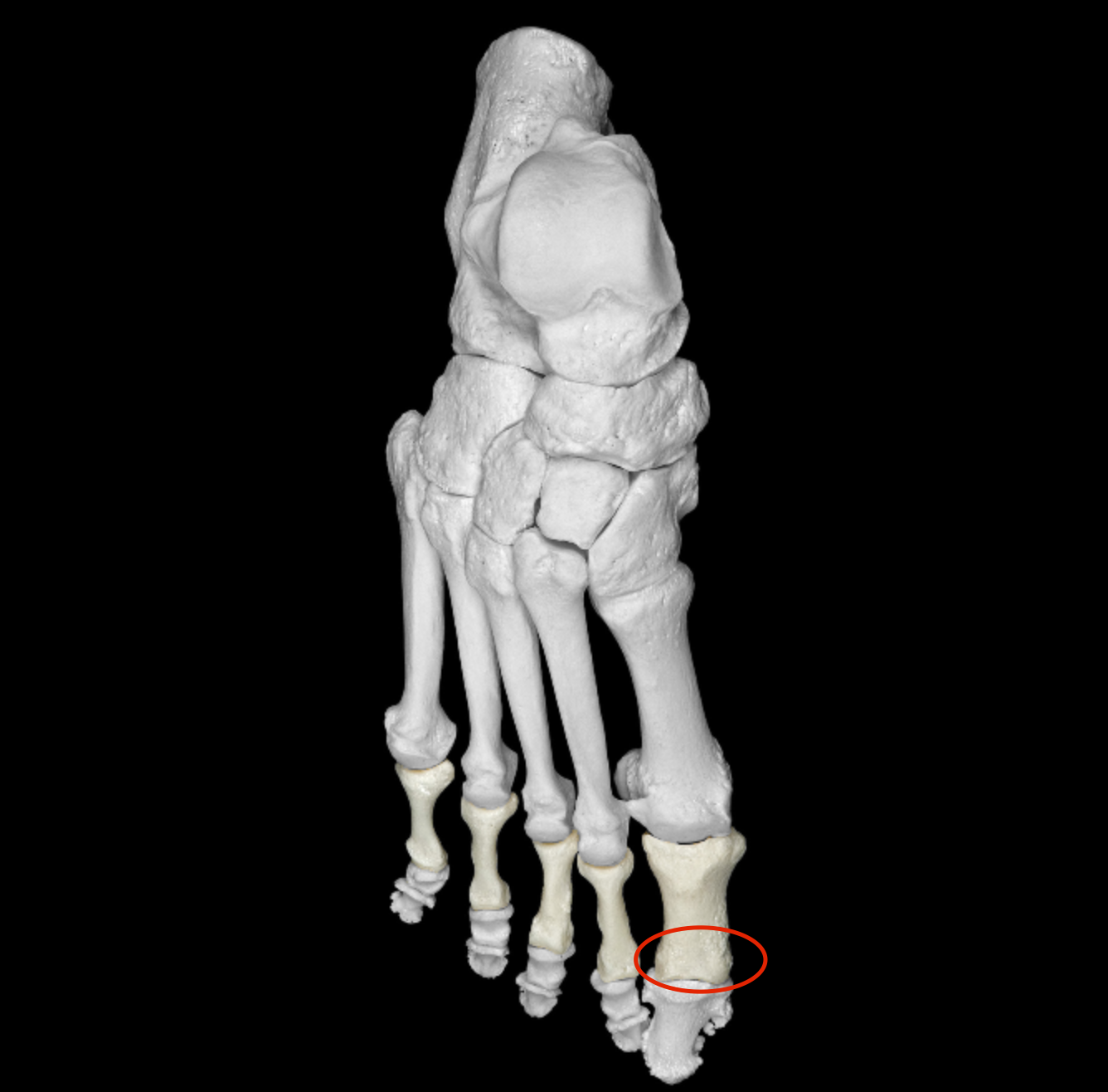 <p>anterior end of phalanx </p>