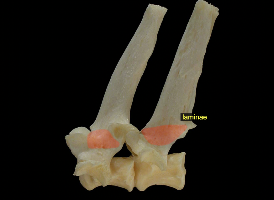 <p>Vertebral arch: Laminae</p>