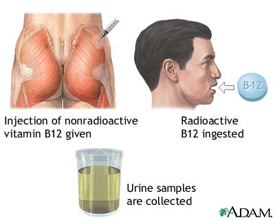 <p>A test which determines a patient’s ability to absorb vitamin B12</p><p>If less than 10% radiolabeled vitamin B12 is detected, there is an impaired absorption</p>