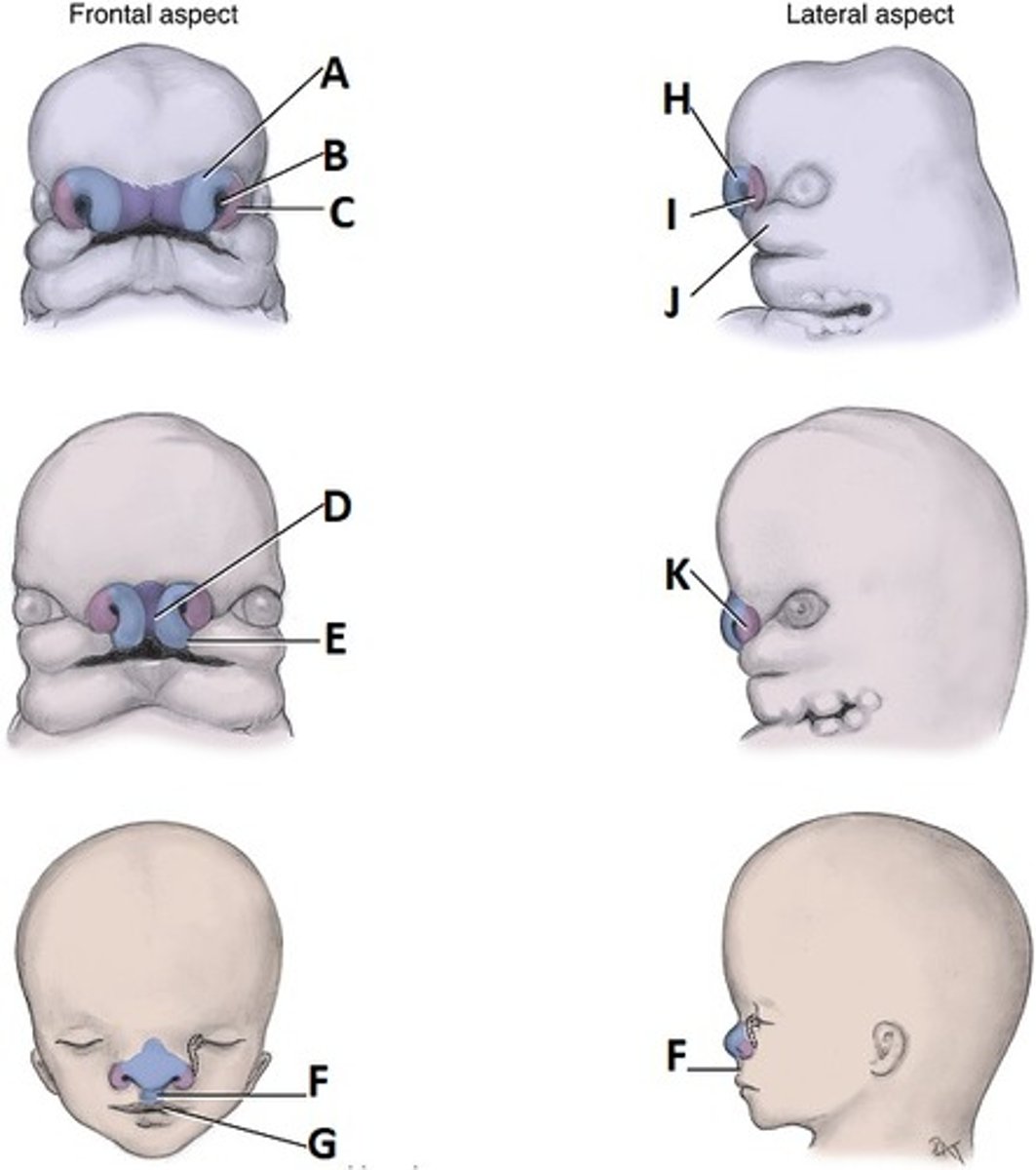 <p><b>frontonasal process</b> --> upper face (forehead, bridge of nose, primary palate, nasal septum, all structures associated with medial nasal processes); <b>placodes --> sense organs</b><br><br>NOSE FORMATION:<br>- tissue around <b>nasal placodes</b> grows --> forms <b>nasal pits</b> --> deepen to form <b>nasal sacs</b> --> <b>oronasal membrane disintegrates</b> to connect oral and nasal cavities while <b>nasal conchae</b> develop on the lateral walls of the nasal cavity<br><br>- <b>medial nasal processes</b> --> fuse together <b>externally</b> to form the <b>middle part of the nose</b> (from root to apex), the tubercle of the upper lip, and the philtrum (end of 7th week)<br>- <b>medial nasal processes</b> --> fuse together <b>internally</b> to form the <b>intermaxillary segment</b> (end of 7th week) --> forms maxillary incisors, primary palate, nasal septum<br><br>- <b>lateral nasal processes</b> --> form the <b>alae</b> of the nose<br><br>- <b>lateral nasal, maxillary, and medial nasal processes</b> --> fuse to form <b>nares</b><br><br><br>PARANASAL SINUS FORMATION:<br>walls of nasal cavity outgrow --> outgrowths become air-filled cavities in bones (sinuses)</p>