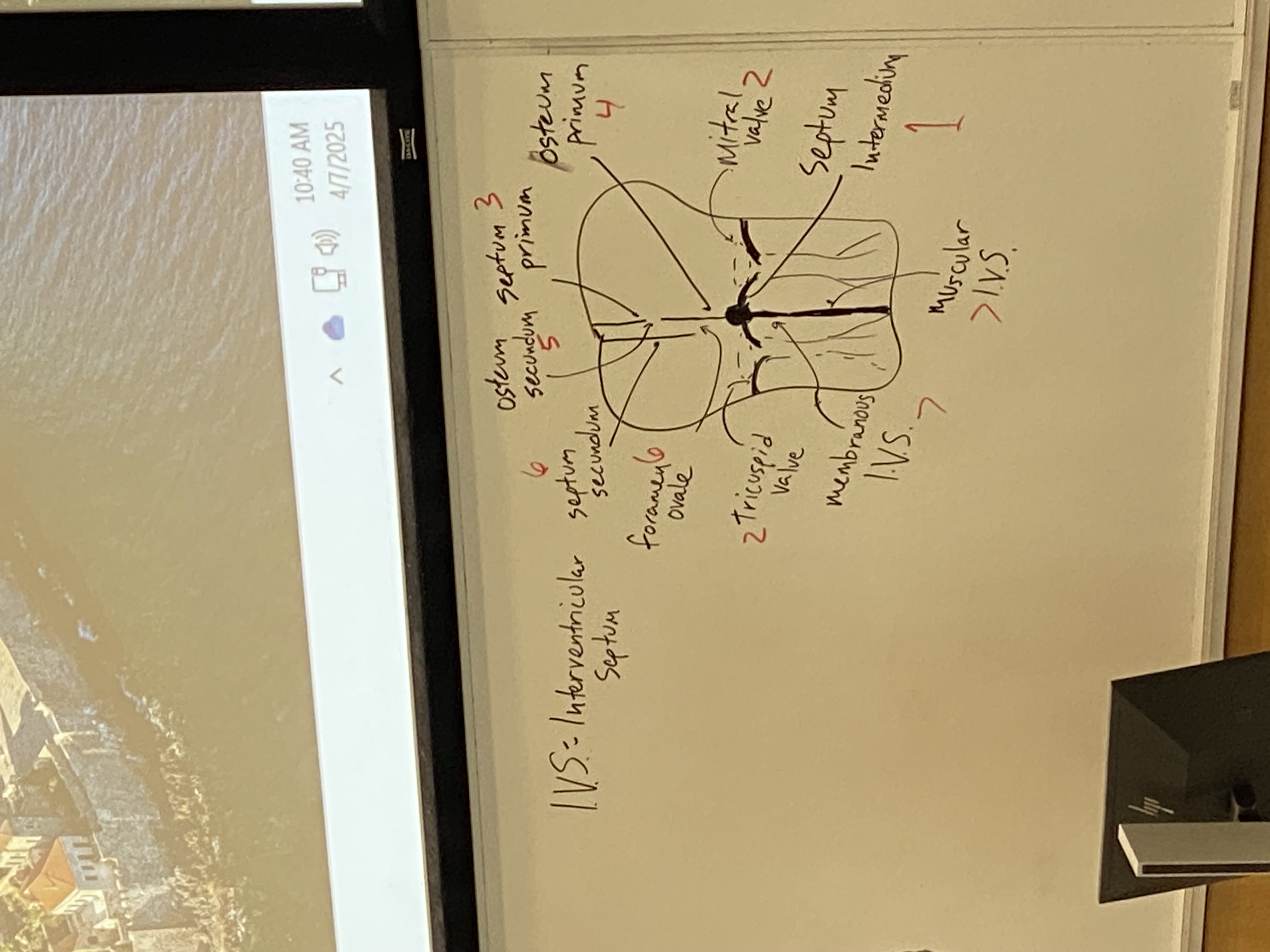 <p>note that the osteum primum is not drawn, it should be a gap at bottom of septum primum just before reaching the septum intermedium</p><p>see bar of tissue bisecting from front to back of heart. in this section, it looks like a dot. called the septum intermedium. serves as organizing center for dividing atria and ventricles (top and bottom; left and right)</p><p>flaps differentiate out from septum intermedium. additional ones assemble on either side as well. atrioventricular valves. some tendons also form from this to prevent backflow of the valves</p><p>mitral valve, tricuspid valve separate the atria from the ventricles</p><p>septum primum doesn’t initially seal off at the bottom but will eventually close that gap (osteum primum) to the septum intermedium, but at the same time a new gap opens up superiorly (osteum secundum)</p><p>septum secundum will form to somewhat block off the osteum secundum but not entirely — leaves an opening. this channel is the foramen ovale</p><p>membranous portion I.V.S. (of the intraventricular septum) and muscular I.V.S.</p><p>we now have both atria and ventricles</p>