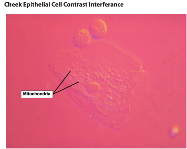 <p>Mitochondria</p>