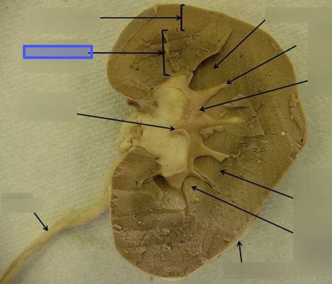 <p>What structure of the kidney is indicted by the blue box?</p>