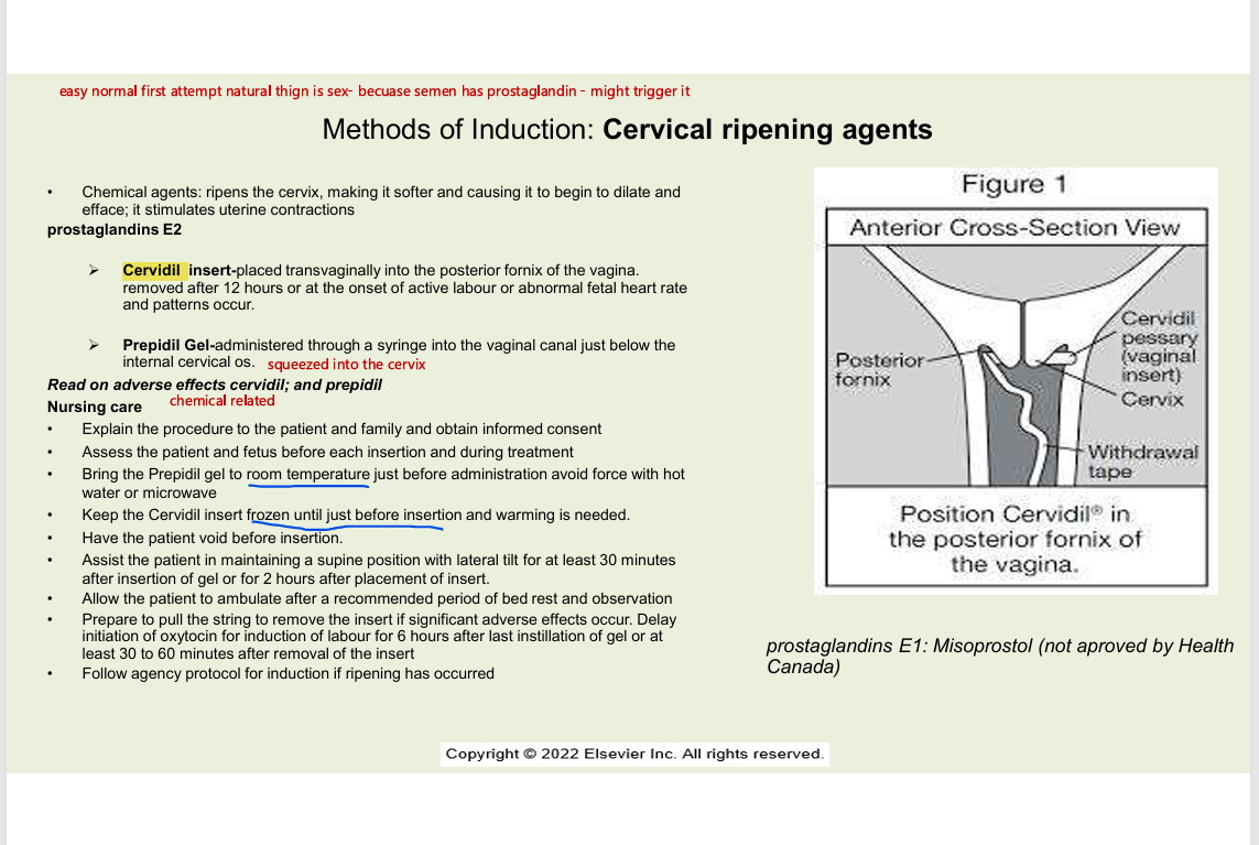 <ul><li><p>chemical agents - ripen the cervix, making ti softer causing ti to begin to dialte and efface</p><ul><li><p>stimulates uterine contractions</p></li></ul></li><li><p>PROSTAGLANDINS E2</p><ul><li><p>CERVIDIL INSERT</p><ul><li><p>transvaginally into the posterior fornix of the vagina</p></li><li><p>removed after 12 hours or at the onset of active labour or abnormal FHR and patterns occur</p></li></ul></li><li><p>PREPIDIL GEL&nbsp;</p><ul><li><p>administered through syringe into the vaginal canal just below the internal cervical os</p></li></ul></li></ul></li><li><p>READ ON ADVERSE EFFECTS OF CERVIDIL AND PREPIDIL</p></li><li><p>nursing care</p><ul><li><p>explain the procedure to the patient and fam - obtain informed consente</p></li><li><p>assess the patient and fetus before each insertion and during treatment</p></li><li><p>bring prepidil gel to room temp just before admin aboid force with hot water or microwave</p></li><li><p>keep cervidil inset frozen until just before insertion and warming is needed</p></li><li><p>pt to void before insertion</p></li><li><p>assist pt in maintaing a supine position w/ lateral tilt for atleast 30 mins after insertion of gel for 2 hours after placement of insert</p></li><li><p>allow the patient to ambulate after recommended period ofbed rest and observation</p></li><li><p>prepare to pull the string to remove the insert if significant AE occurs. delay initiation of oxytocin for induction of labour for 6 hrs after last instillation of gel or atleast 30-60 mins after removal of the insert</p></li><li><p>follow agency protocol for induction if ripening occurs</p></li></ul></li></ul><p></p>