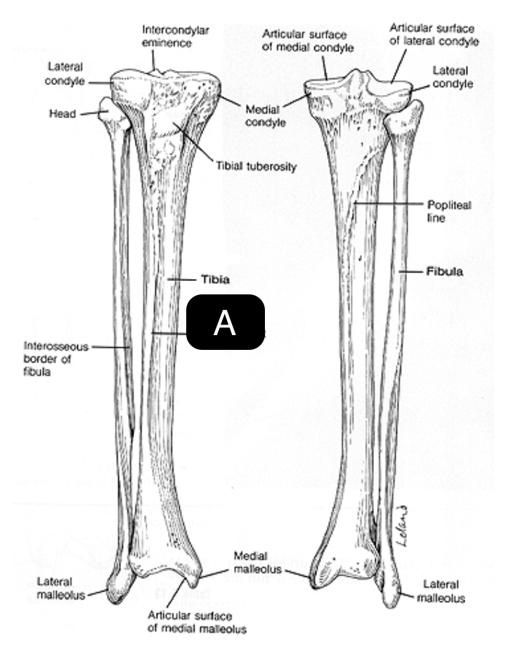 <p>A</p>