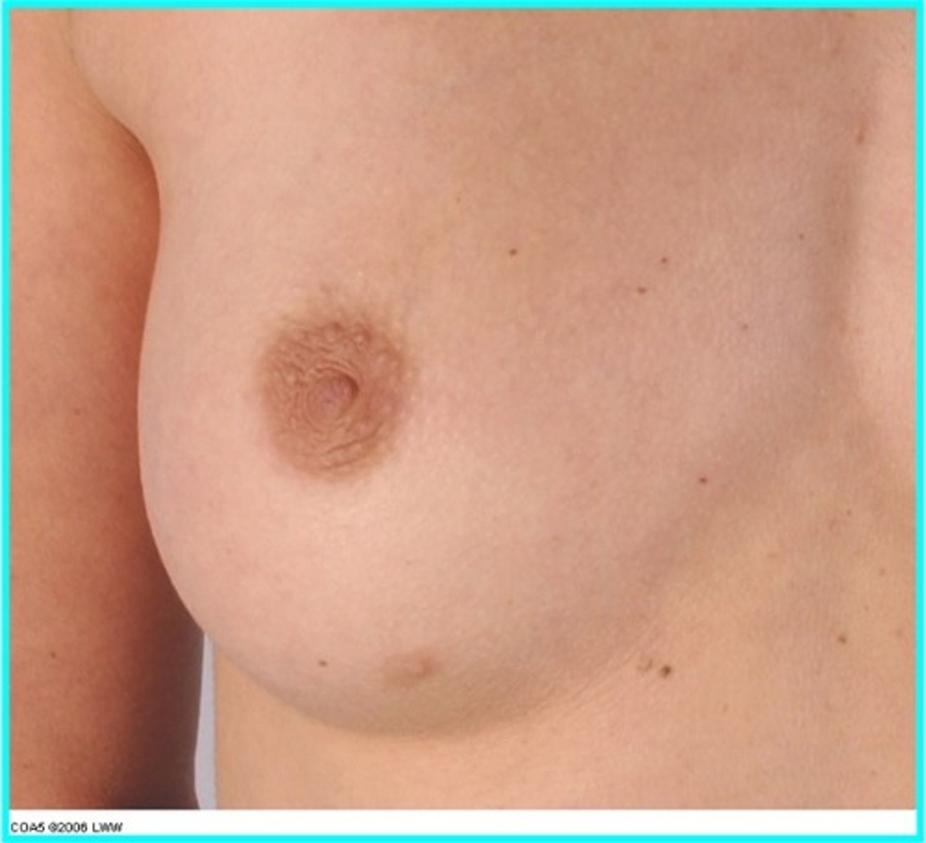 <p>The frequency of breast cancer and its spread to other parts of body by lymph and blood vessels. You would palpate areas around breast and to umbilicus.</p>