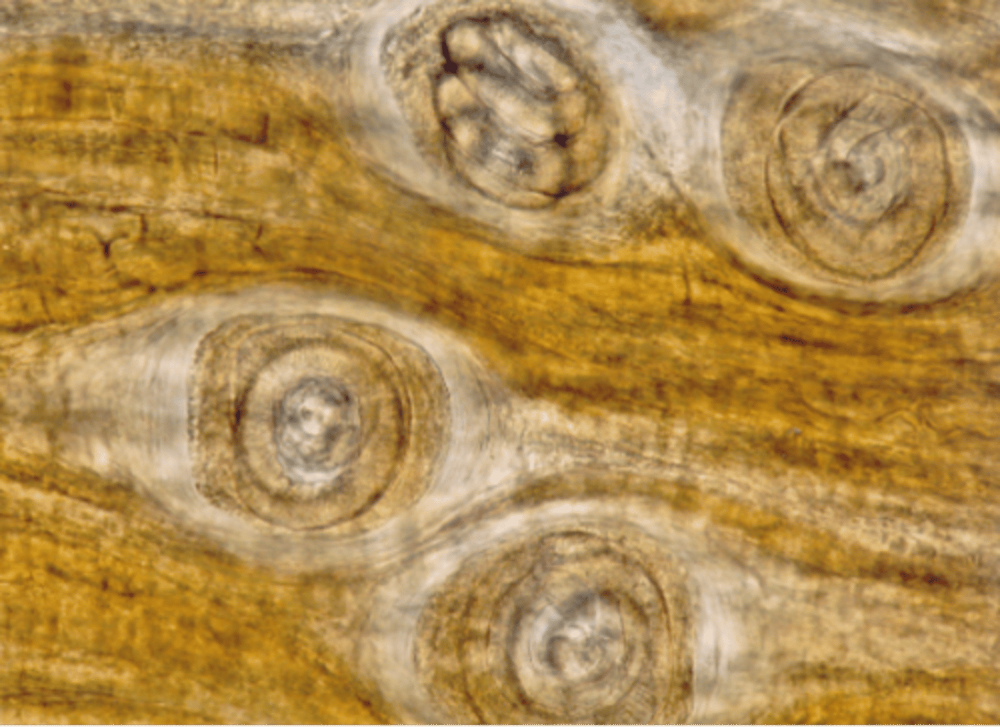 <p>Found in a sow whose farmer had severe gastritis. What parasite is this?</p>