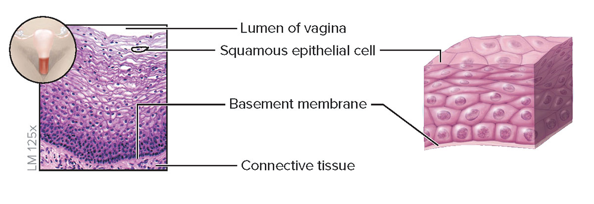 <p><strong>Structure</strong></p><p>Multiple cell layers; basal cells are cuboidal or polyhedral, whereas apical (superficial) cells are squamous; cells lack keratin; superficial cells are alive and kept moist</p><p><strong>Function</strong></p><p>Protection of underlying tissue from abrasion</p><p><strong>Location</strong></p><p>Lining of oral cavity, part of pharynx, part of larynx, esophagus, lining of vagina, and anus</p>