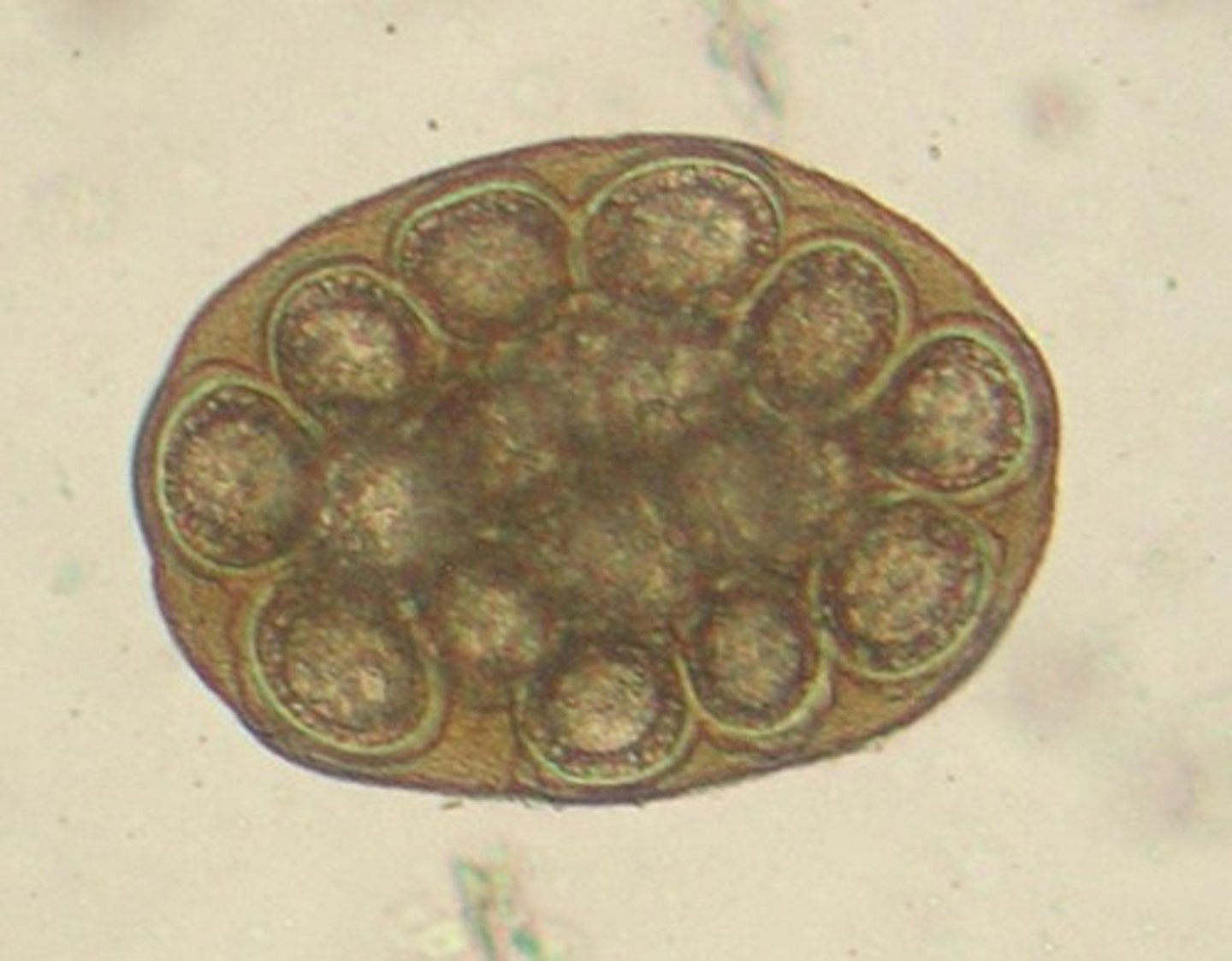 <p>Identify the parasite</p>