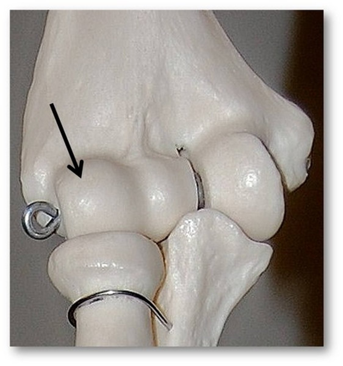 <p>Name this specific part of the humerus.</p>