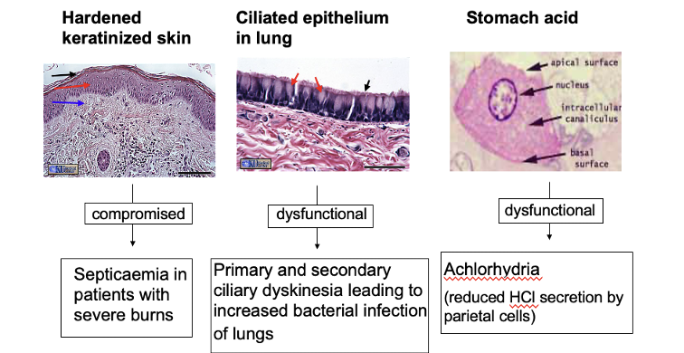 <ul><li><p>Keratinised skin </p></li><li><p>Ciliated epithelium in lung </p></li><li><p>Stomach acid </p></li></ul><p>→<span>exterior surfaces can also secrete proteins that protect those surfaces from colonisation (lysosome which breaks down peptidoglycan and anti-microbial peptides which disrupts the bacteria membrane)</span></p><p></p><p></p>