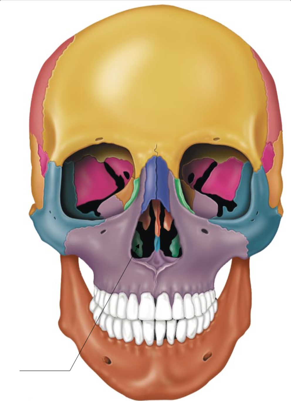term image