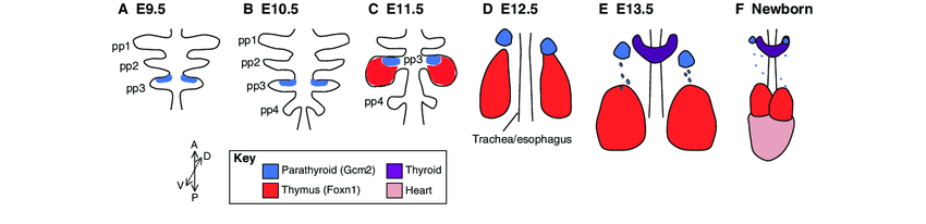 <p>FOXN1 est un <strong>facteur de transcription essentiel</strong> pour :</p><ul><li><p>la formation des cellules épithéliales thymiques</p></li><li><p>la peau.</p></li></ul><p><strong>Mutation de FOXN1: </strong>Elle peut entraîner :</p><ul><li><p>absence de thymus</p></li><li><p><strong>SCID</strong></p></li><li><p>alopécie</p></li><li><p>anomalies des ongles.</p></li></ul><p></p><p></p>