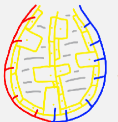 <ul><li><p>before birth</p><ul><li><p>breathing in amniotic fluid</p></li></ul><p></p></li><li><p>during birth</p><ul><li><p>air breathed in→ amniotic fluid ‘sucked up’ by pulmonary capillaries</p></li><li><p>all that should remain is surfactant</p></li></ul></li></ul><p></p>