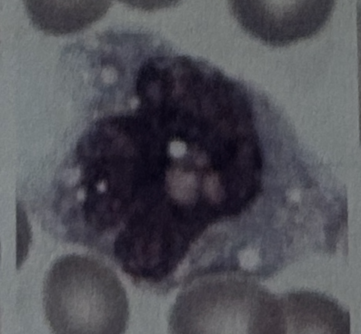 <p>WBC</p>