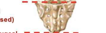<p>5 fused bones that make up this part of the vertebral column </p>