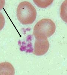 <p>TC Especial Sangre (<strong>Plaquetas</strong>)</p>