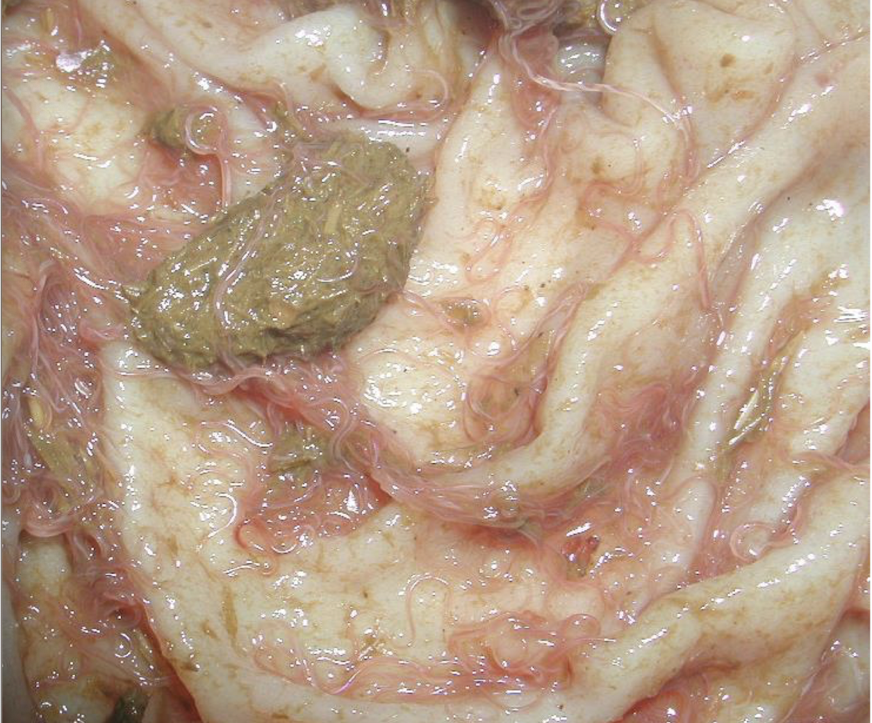 <p>Which mechanism of edema is responsible from bottle jaw caused by the barber pole worm?</p>