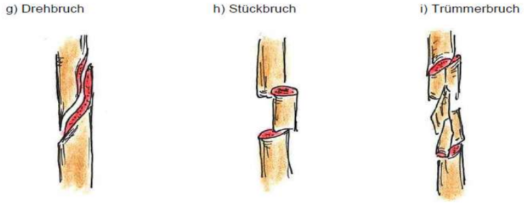 <p>g) Drehbruch</p><p>h) Stückbruch</p><p>i) Trümmerbruch</p>