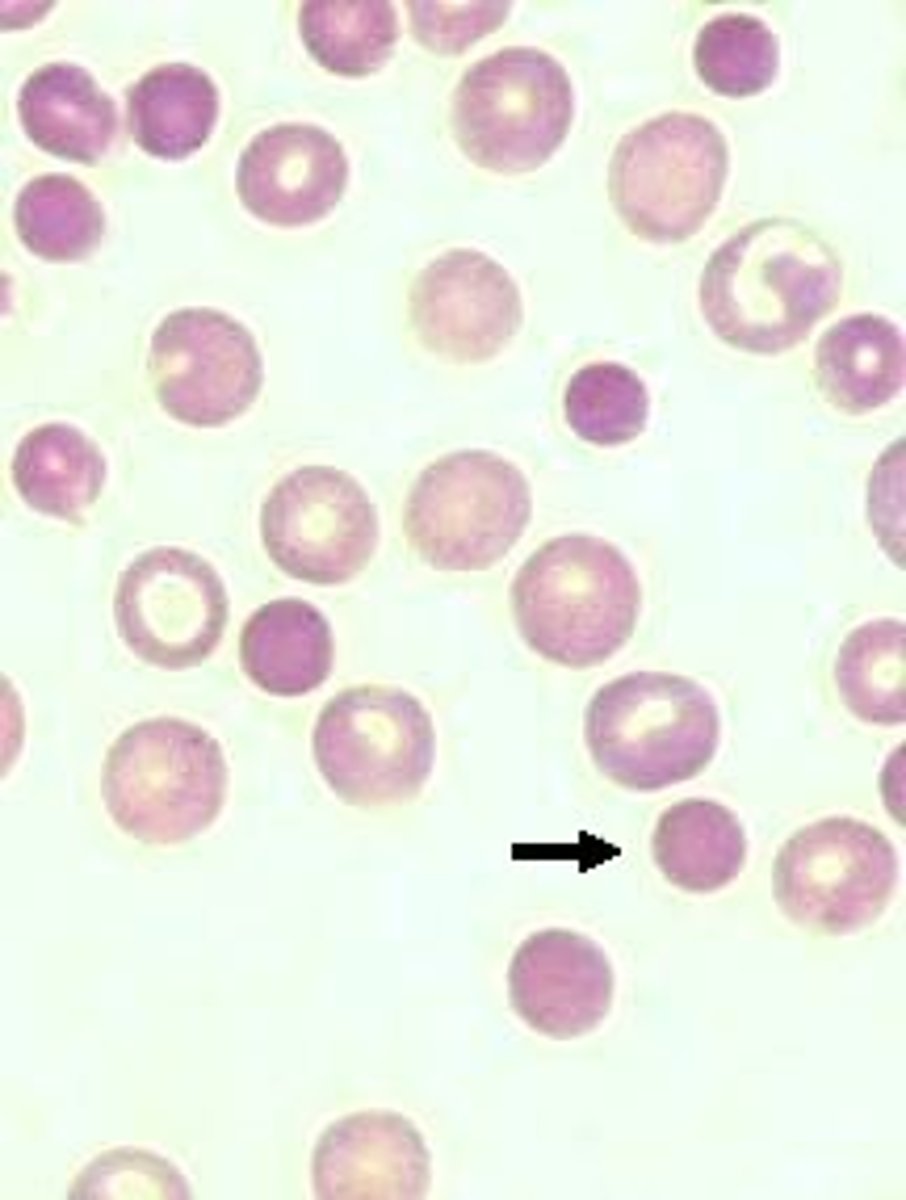 <p>very small, dense erythrocytes with no central pallor</p><p>- indicates IMHA</p><p>- only identified in dogs</p>