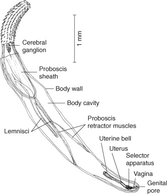 <ul><li><p>Meaning prickly head</p></li><li><p><strong>1-2 ligament sacs that support the gonads</strong></p></li><li><p><strong>Have a proboscis with intracellular hook</strong></p></li><li><p>All are parasitic in vertebrates, with an intermediate host in arthropods</p></li><li><p>They were previously placed in a separate grouping but molecular data places them as rotifers.</p></li><li><p>Three body parts:</p><ul><li><p><strong>Proboscis - hollow and retractable with hooks or spines</strong></p></li><li><p>Neck</p></li><li><p>Trunk with pseudocoel</p></li></ul></li><li><p><em>No main organ systems and reduced sensory structures - since they do not need to develop them if they get broken down food from host.</em></p></li><li><p>Reproduction - <strong>mostly gonad, separate sexes (internal fertilization, males have a cement gland, and females have ovarian ball and uterine ball</strong>), acanthor (mature embryo) larvae</p></li></ul><p></p>