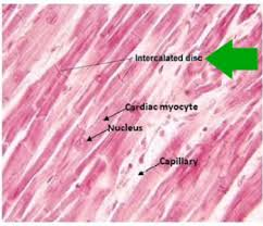 <p>muscle tissue found only in the <strong>heart</strong></p><ul><li><p>involuntary</p></li><li><p>striated</p></li><li><p>intercalated disc</p></li></ul><p></p>