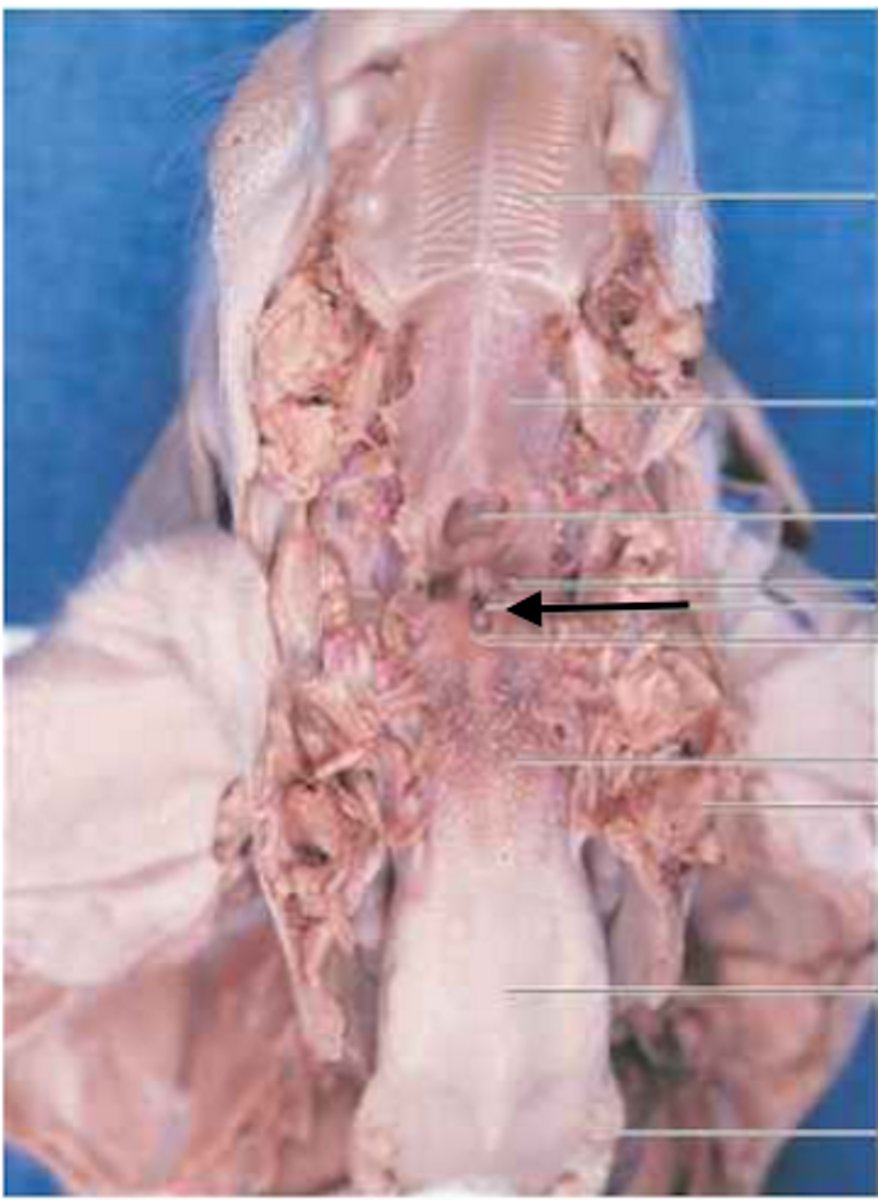 <p>The opening between the vocal cords and the upper larynx. The epiglottis covers this.</p>