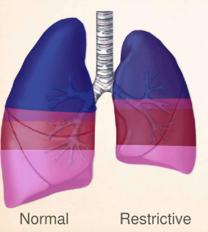 <p>Explain why the restricted lung is smaller?</p>