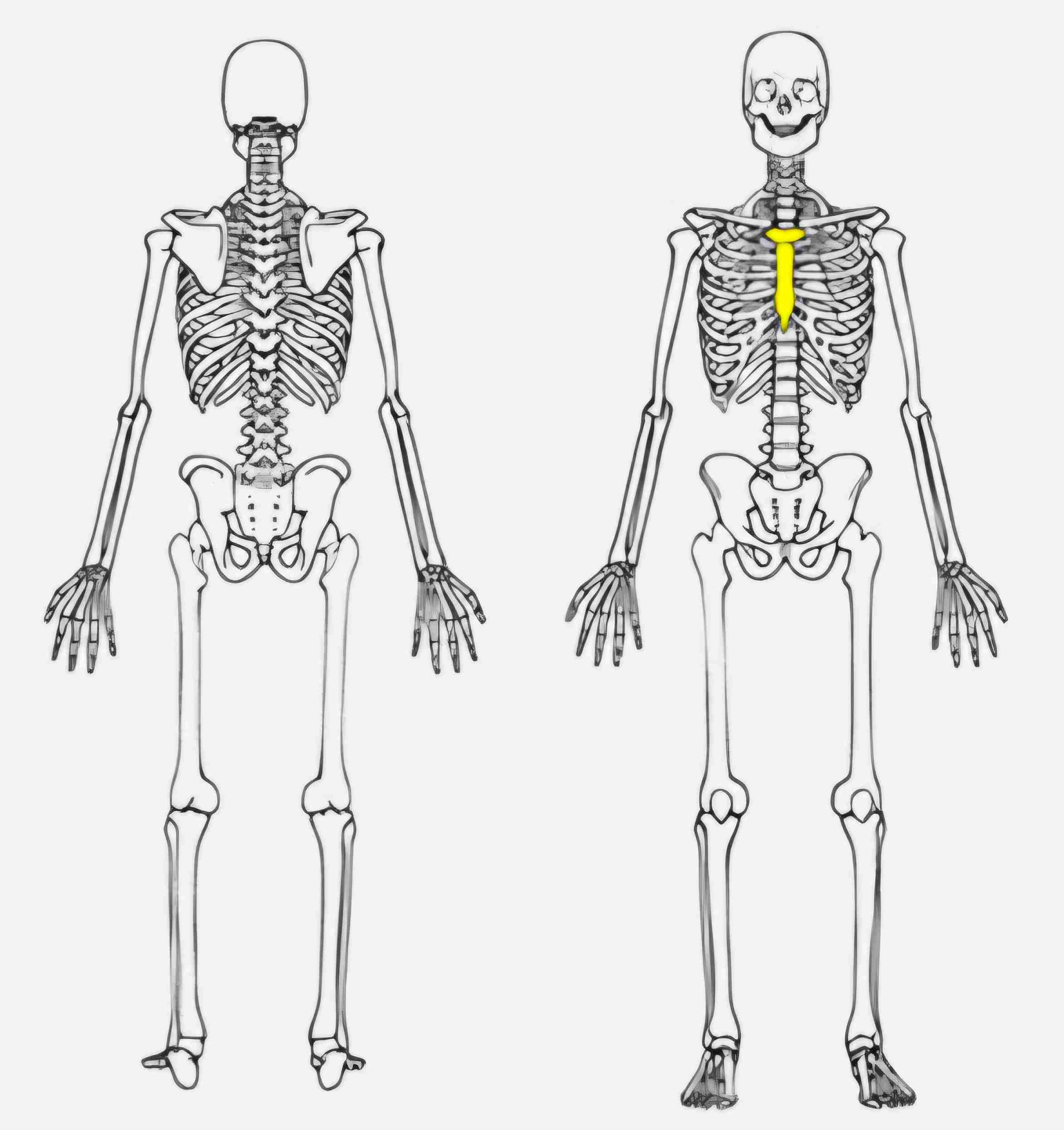 <p>What bone is this?</p>