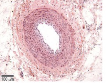 <p>Outline the structre of the artery</p>