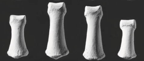 <p>Finger bones that articulate with distal and proximal phalanges. Not present in the thumbs</p>