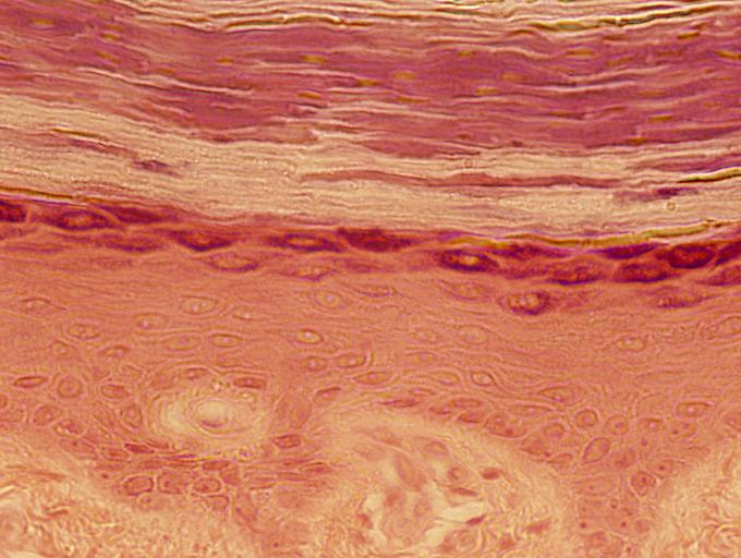 <p>stratified squamous epithelial tissue</p>