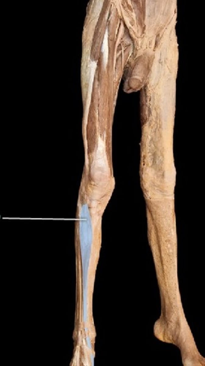 <p>What muscle is this?</p>
