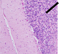 <p>Name Region/Part of Brain, Be Specific</p>