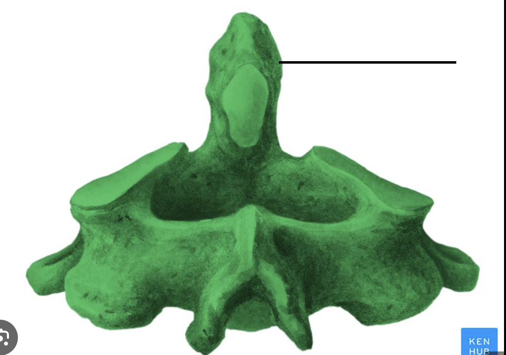 <p>What bone marking is this?</p>