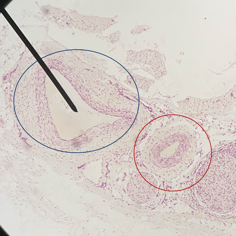 <p>Name the blood vessel in the red circle</p>