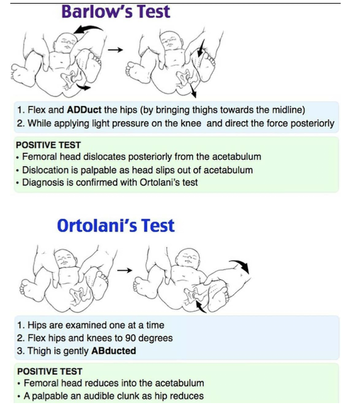 <p><span style="color: blue"><strong><u>newborn screening at 24-72hrs, repeat at every well-child check up 6 months:</u></strong></span><br><strong><u>Barlow</u>: </strong>hip <strong>dislocates</strong>/<strong>subluxes</strong> with gentle pressure externally rotated <br><strong><u>Ortolani</u></strong>: <strong>hip</strong> <strong>reduces out to in </strong><br><strong><u>Galeazzi</u></strong>: limb length discrepancy</p><p><span style="color: blue"><strong><em>Ultrasound if risk factors or positive screening test (XRAY &gt;6 months)</em></strong></span></p><p><strong>after 1 year: </strong>may present as gait abnormality, pelvic obliquity/lumbar lordosis</p>