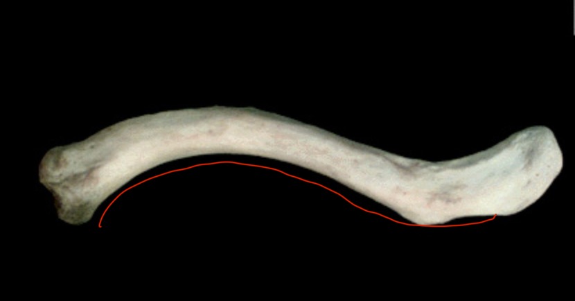 <p>What structure is this?</p>