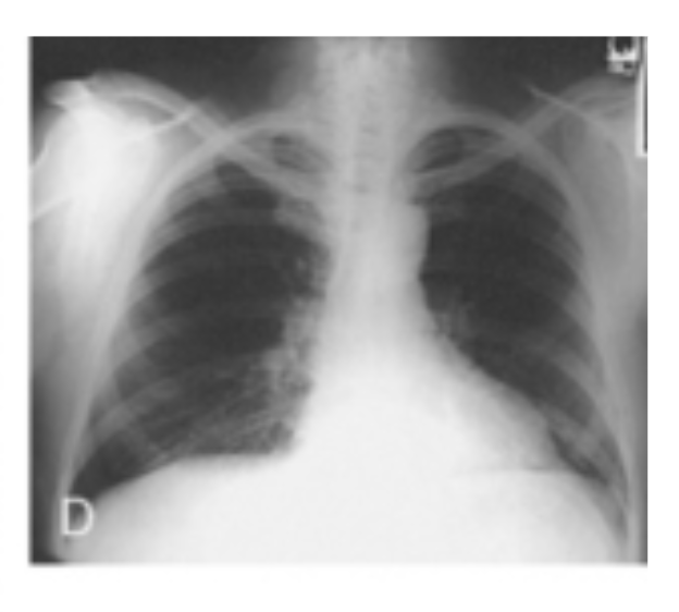 <p>Identify which body habitus this is</p>