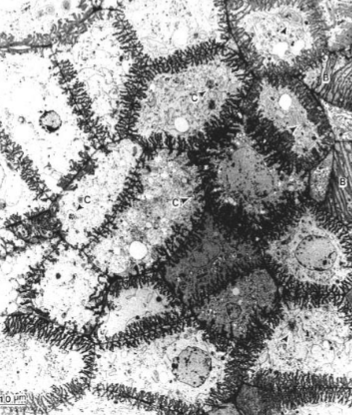 <p>Specialized Parenchyma</p><ul><li><p>Short distance transport</p></li><li><p>Associated w/ vascular tissues and conducting cells</p></li></ul><p></p>