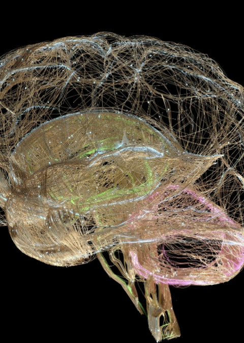 <ul><li><p><span style="color: rgb(0, 0, 0);">Handles motor, sensory, special senses (vision, hearing, taste, smell)</span></p></li><li><p><span style="color: rgb(0, 0, 0);">Largely symmetrical</span></p></li><li><p><span style="color: rgb(0, 0, 0);">Lesions here are more straightforward</span></p></li></ul><p></p>