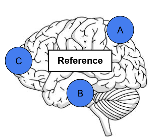 <p>According to the reference point, what are the locations of the following letters?</p><p>A = </p><p>B = </p><p>C = </p>