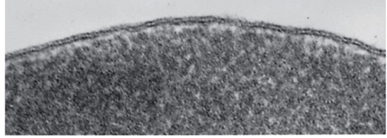 <p>PASS THROUGH SPECIMEN</p>