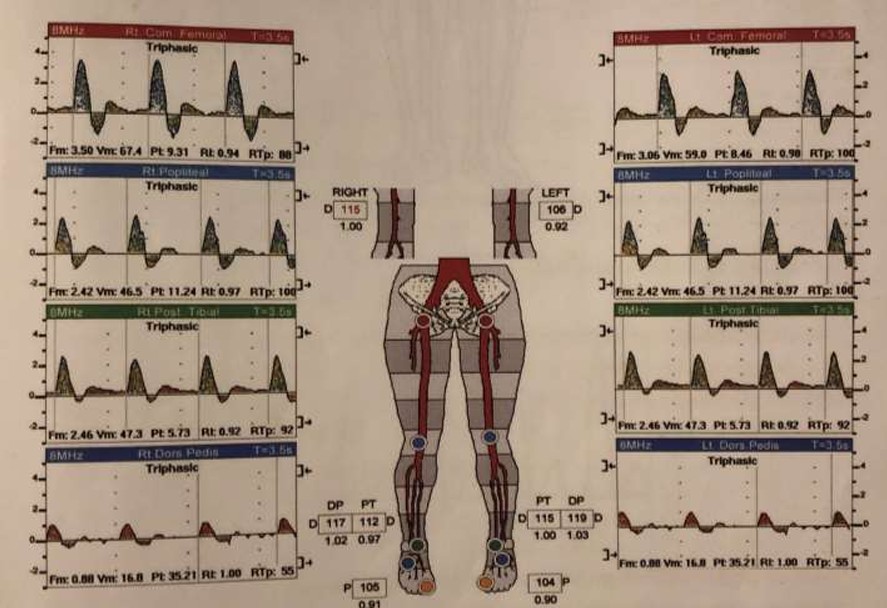 <ol><li><p>Which leg is normal?</p></li><li><p>Which leg is abnormal?</p></li></ol><p></p>