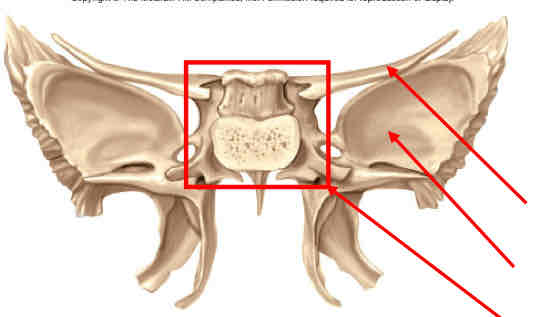 term image