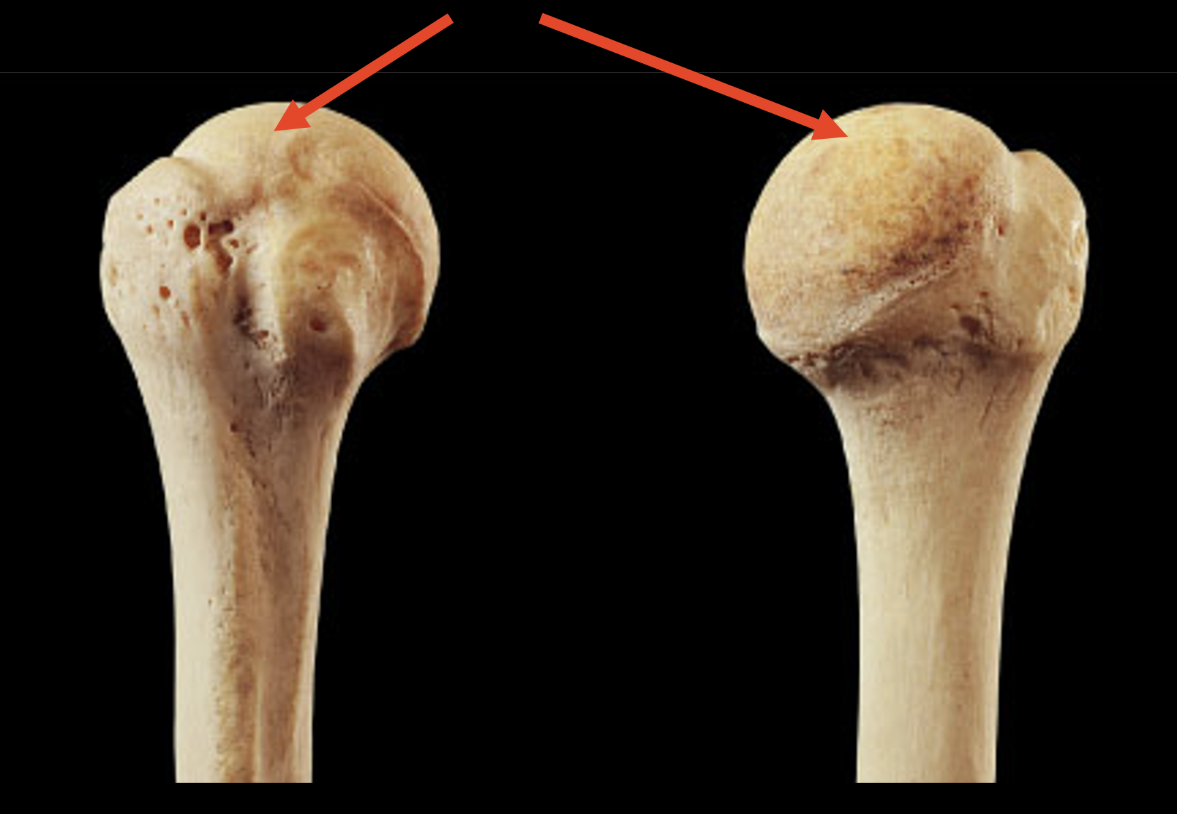 <p>Name this region of the humerus</p>