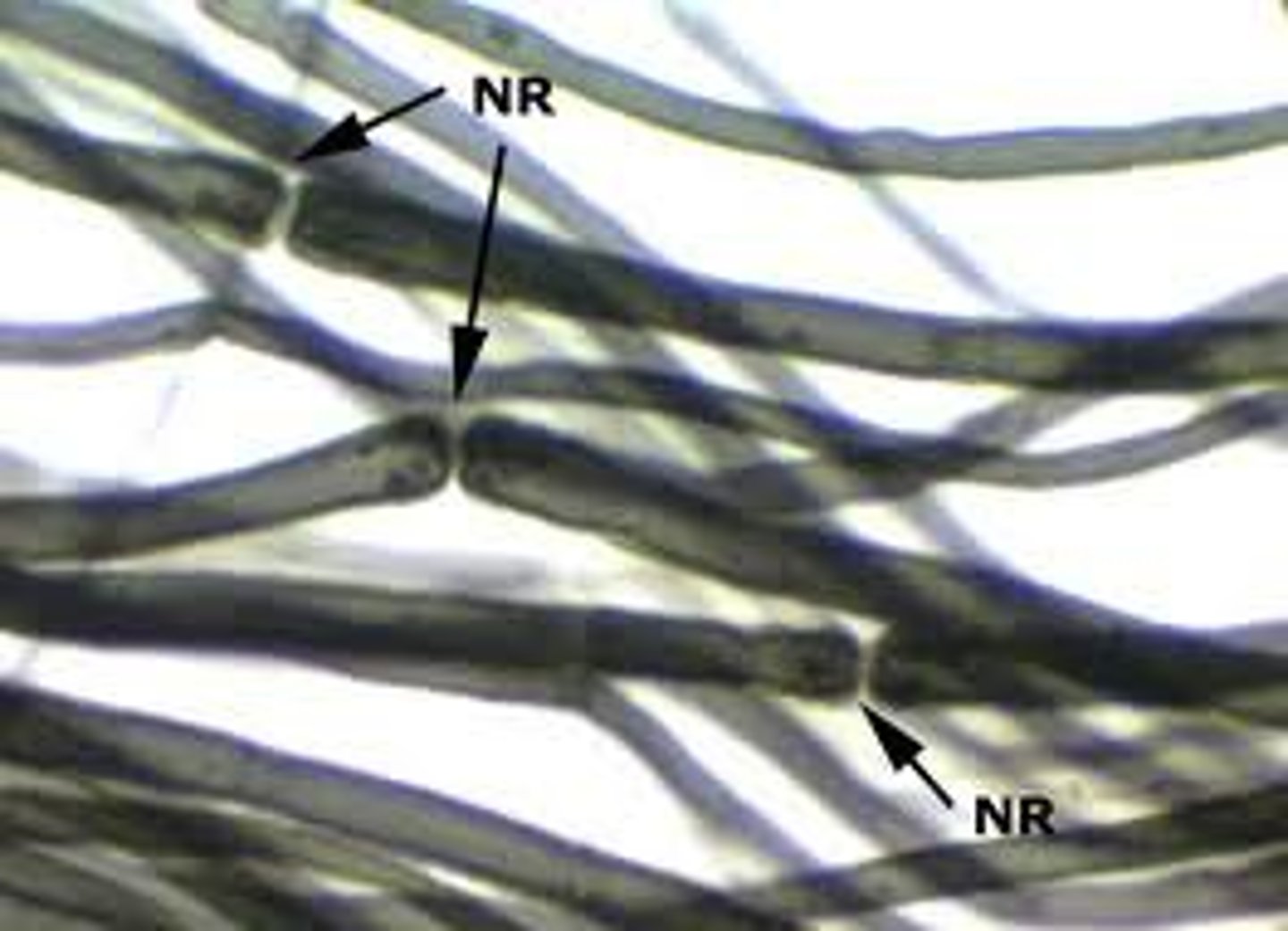 <p>gaps in the myelin sheath</p>