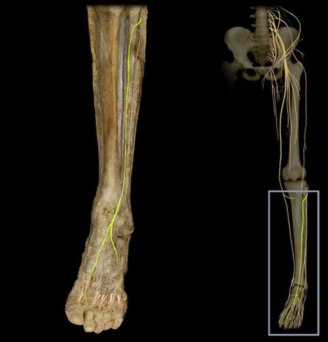 <p>Rising between the fibularis longus and neck of fibula, it innervates the extensor digitorum and hallucis brevis.</p>